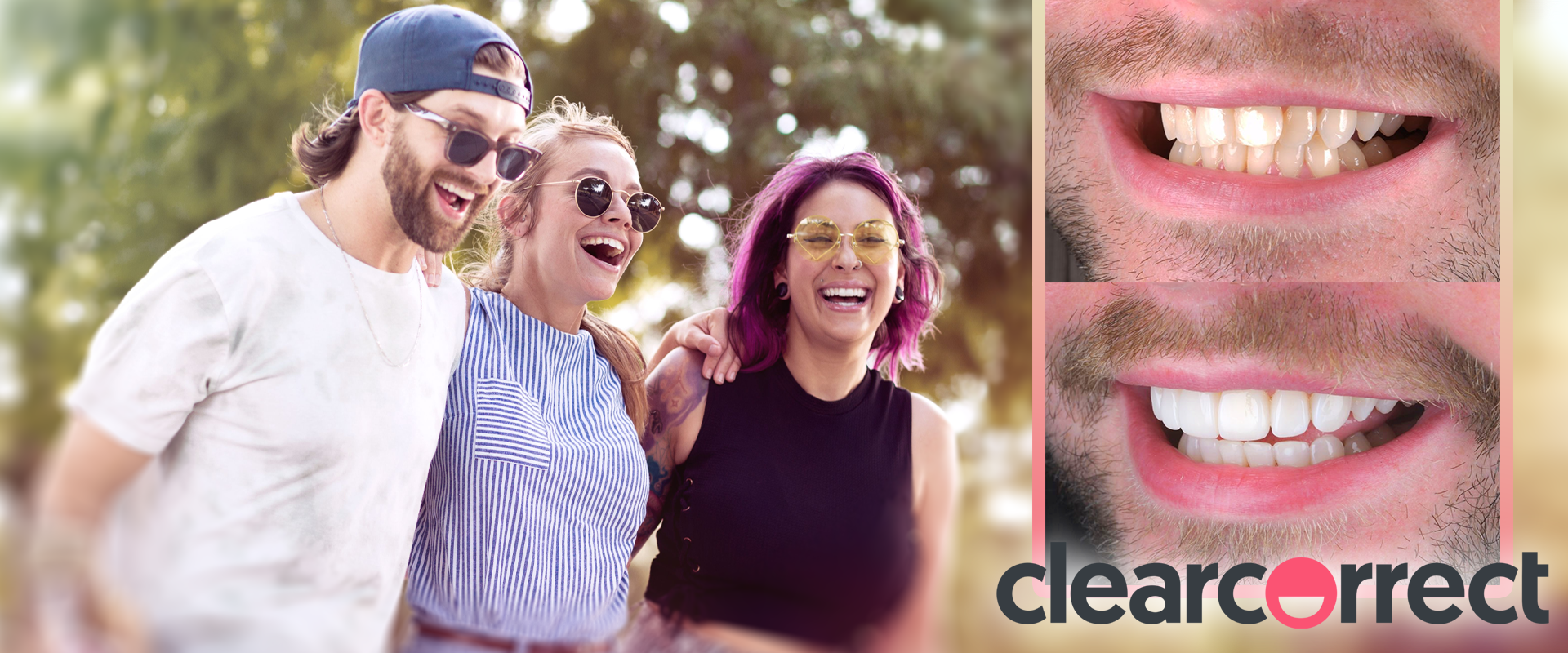 ClearCorrect Aligners - UK