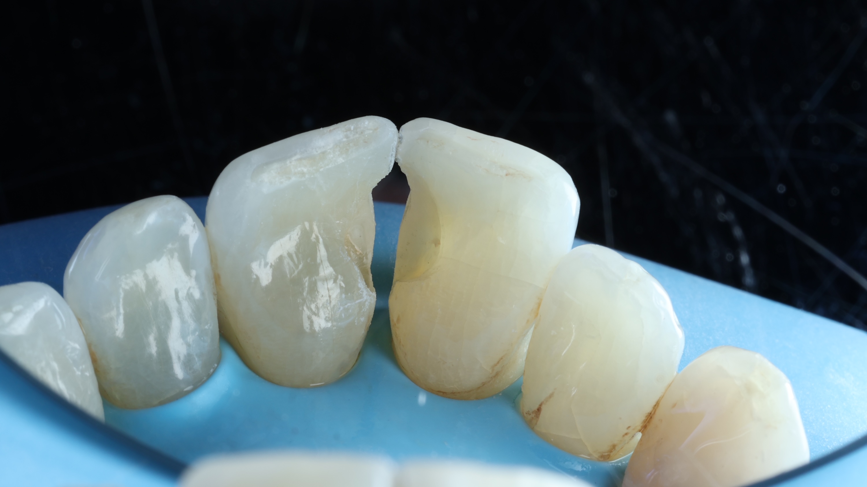 Restorative Space Closure